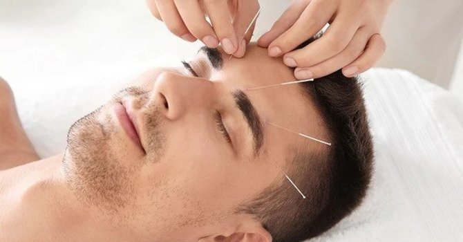  The Healing Touch: Renewal Wellness Center's Expertise in Acupuncture image