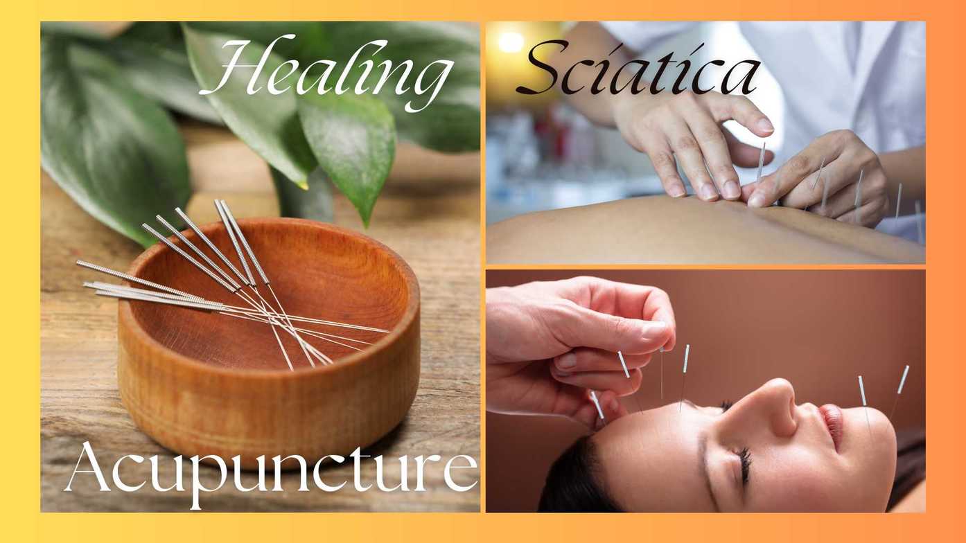 Acupuncture for Sciatica 
